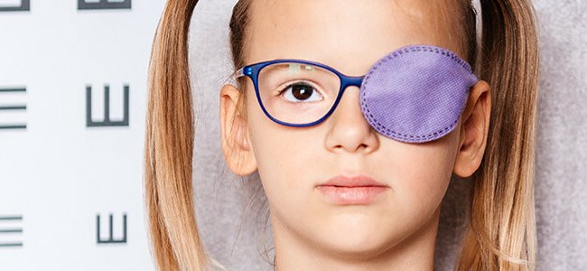 Lazy eye or amblyopia: symptoms, causes and treatments