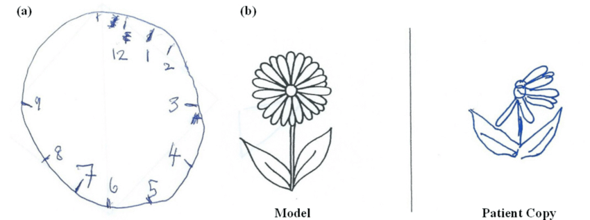 Figure 3. Copies of figures (model vs. patient copy)