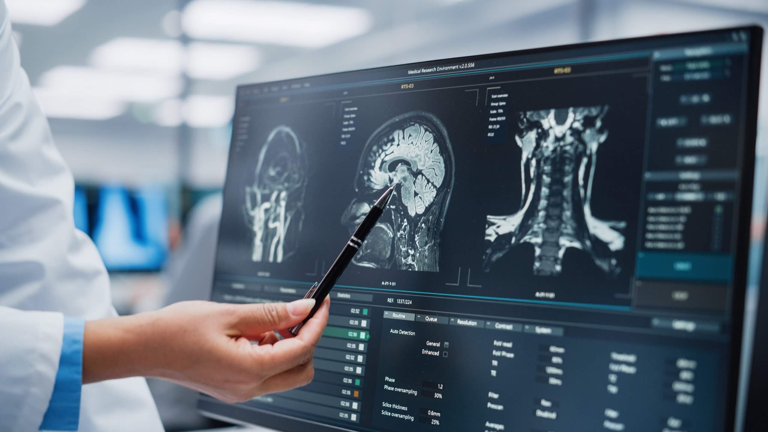 Ospedale medico: Neurologo e neurochirurgo discutono i risultati di una risonanza magnetica funzionale del cervello