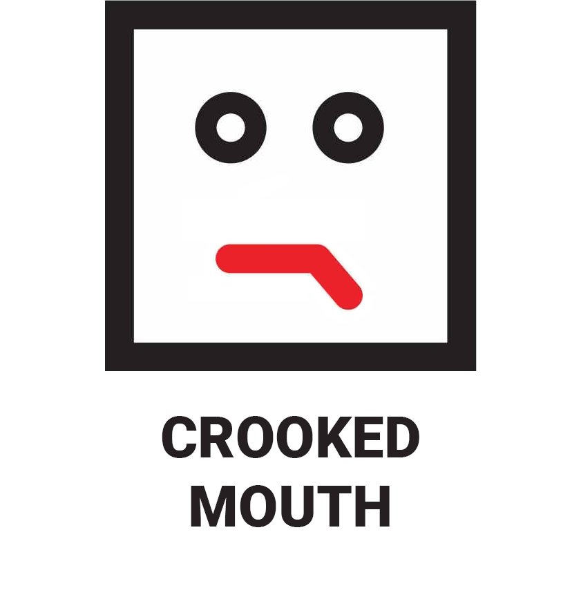 Stroke - Crooked mouth